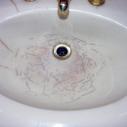 myh cracked acrylic basin